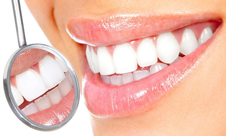 7 prirodnih načina za izbeljivanje zuba