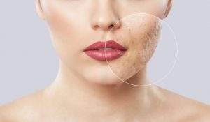 problematicna-koza-shutterstock_1346981630-910x531-1