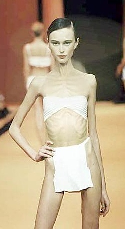 anoreksija i bulimija ~ sve učestaliji poremećaji ishrane