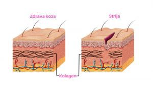 zdrava-koza-2-1
