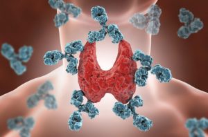 Autoimmune thyroiditis, Hashimoto's disease. 3D illustration showing antibodies attacking thyroid gland