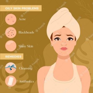 flat-hand-drawn-oily-skin-problems-infographic_52683-56752