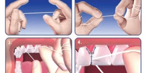 flossing-460x230-1