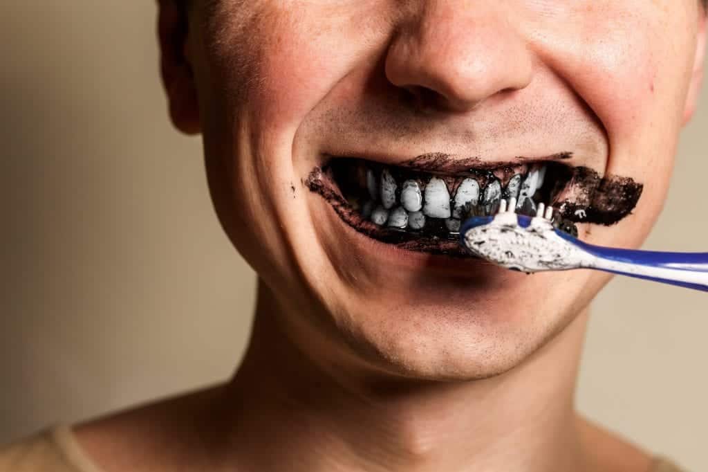 izbeljivanje zuba kod kuće: na prirodan način!
