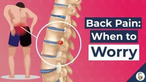 Video Thumbnail: Low Back Pain Causes (and 7 Worrying Signs)